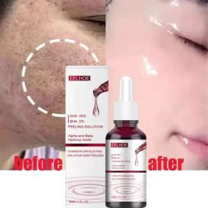 Salicylic Acid Pore Shrinking Serum
