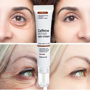 Eye cream Which Removes Eye Bags and Puffiness
